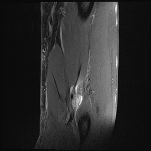 Click on the Serie image to view the images of Wieszt, Gnter